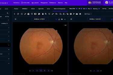 Topcon Harmony permte a los ópticos y oftalmólogos recorrer fácilmente los historialesde los pacientes y las imágenes del OTC.