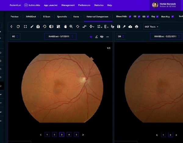 Topcon Harmony permte a los ópticos y oftalmólogos recorrer fácilmente los historialesde los pacientes y las imágenes del OTC.