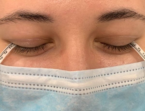 El ojo seco afecta a más de cinco millones de personas en España